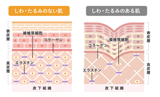 20240831ws8xy_